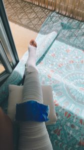 Rompi o ligamento do Joelho